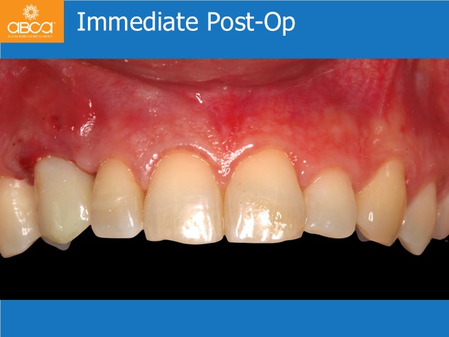 Clinical Case