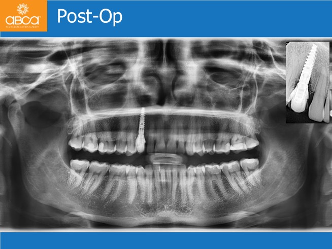 Clinical Case