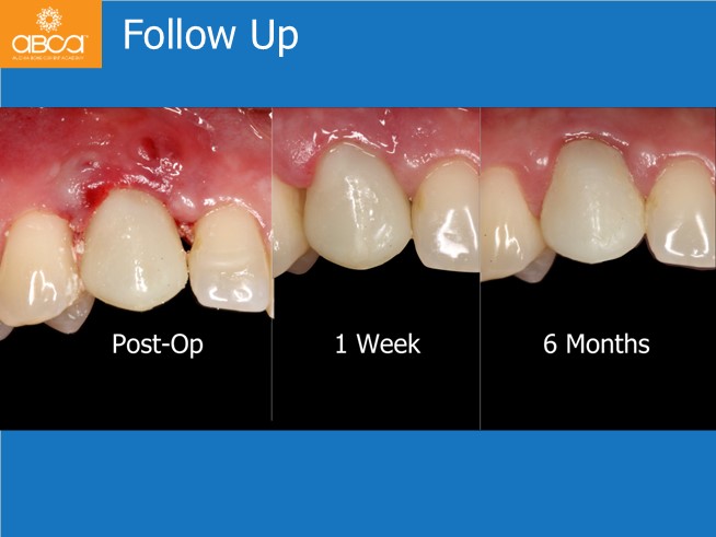 Clinical Case