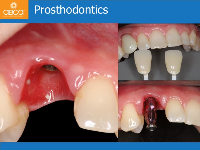 Clinical Case