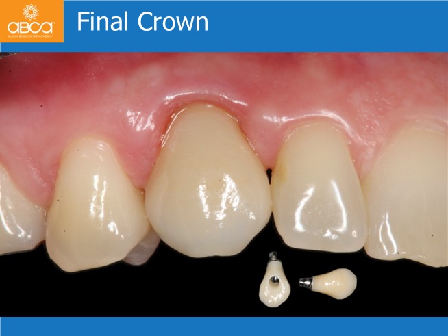 Clinical Case