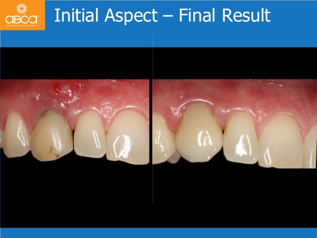 Clinical Case