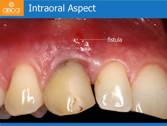 Clinical Case