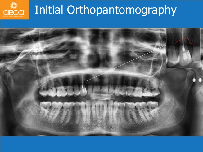 Clinical Case