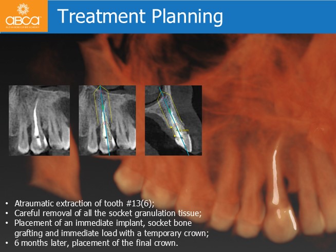 Clinical Case