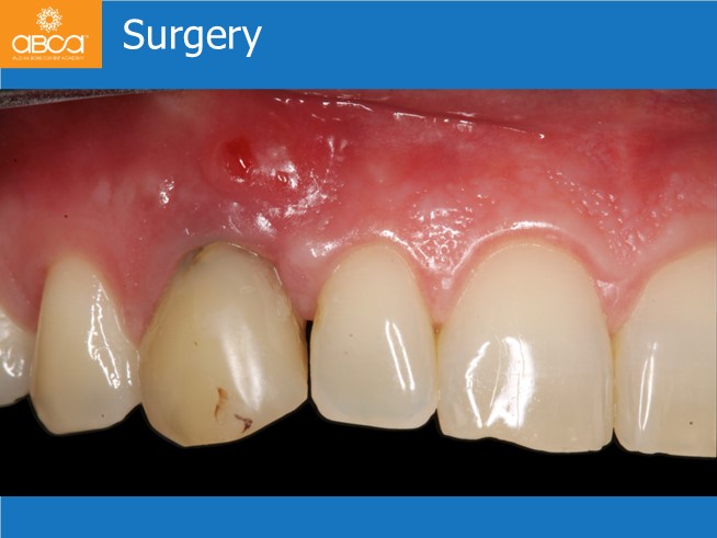 Clinical Case