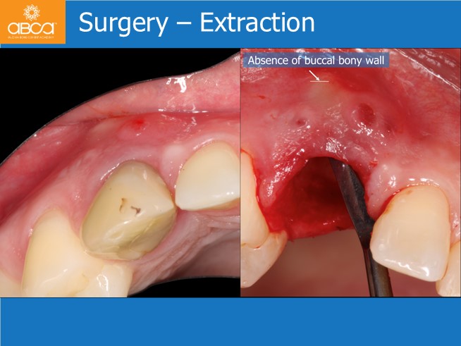 Clinical Case