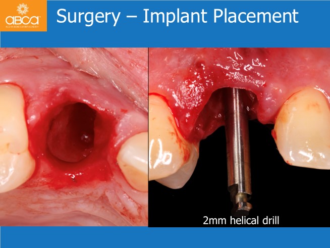 Clinical Case