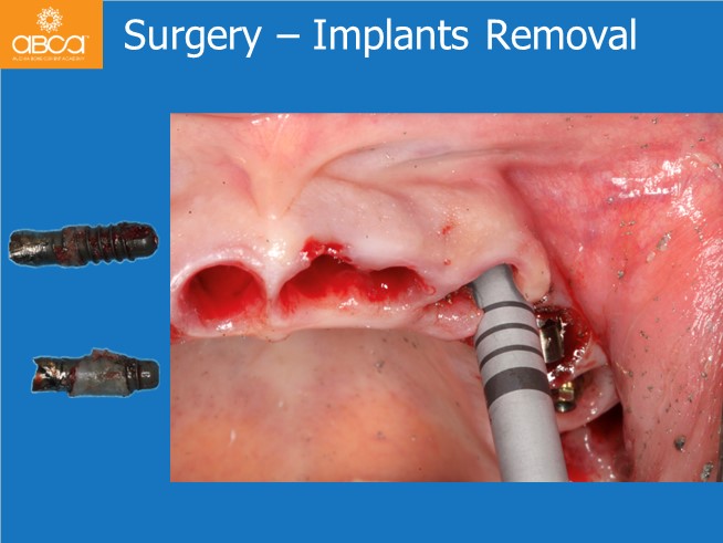 Clinical Case