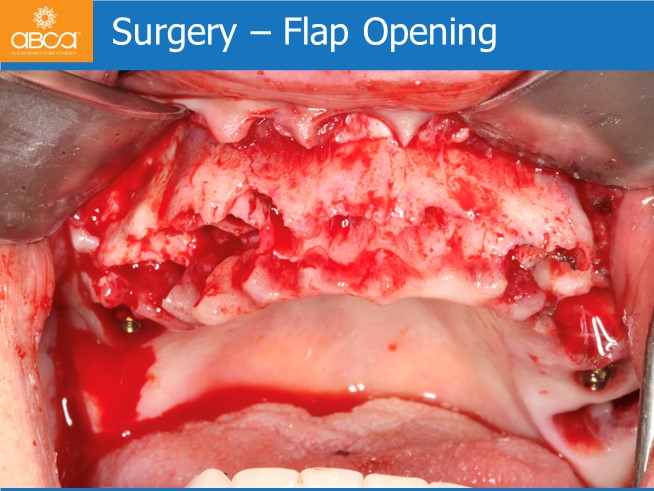 Clinical Case