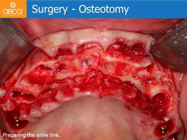 Clinical Case