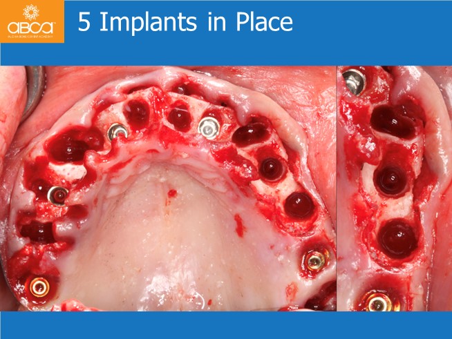 Clinical Case