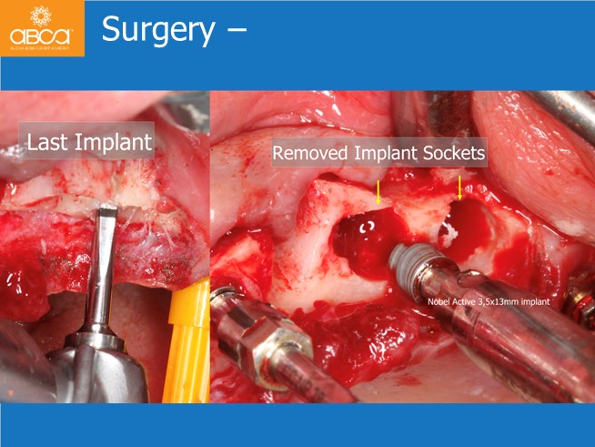 Clinical Case