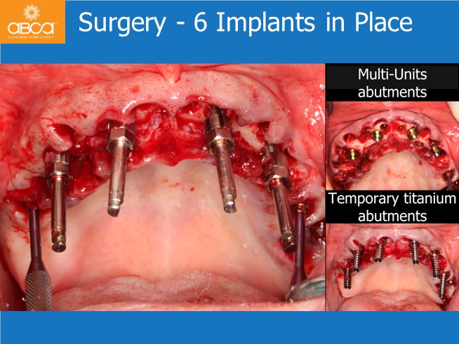 Clinical Case