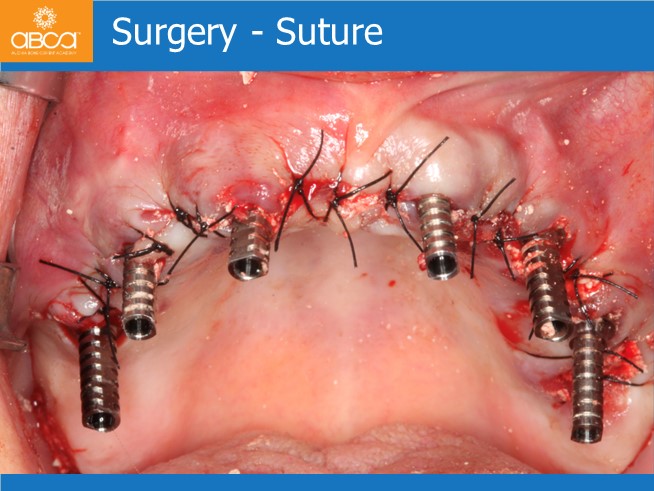 Clinical Case