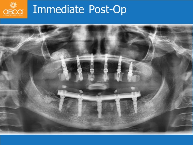 Clinical Case