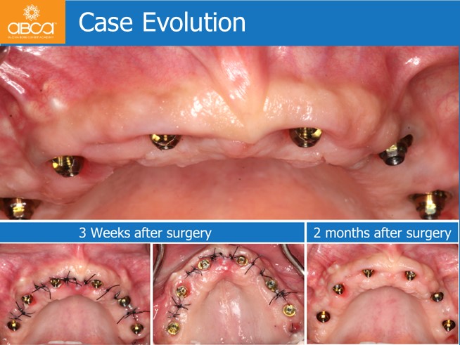 Clinical Case