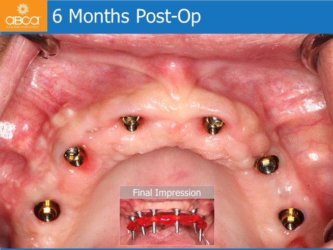 Clinical Case