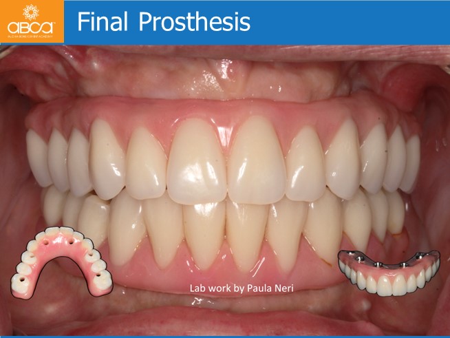 Clinical Case