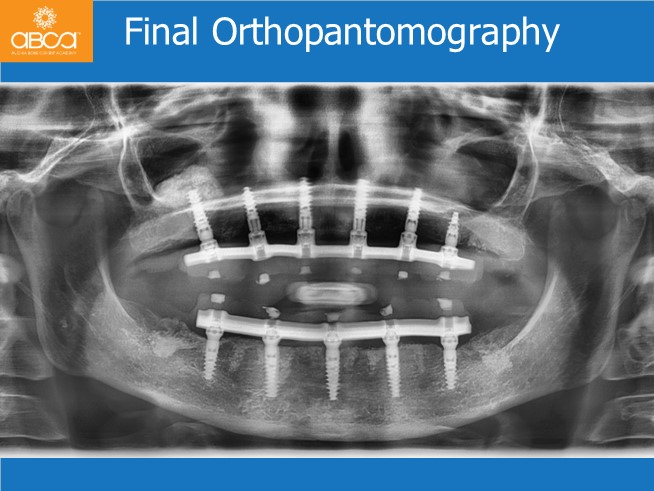 Clinical Case