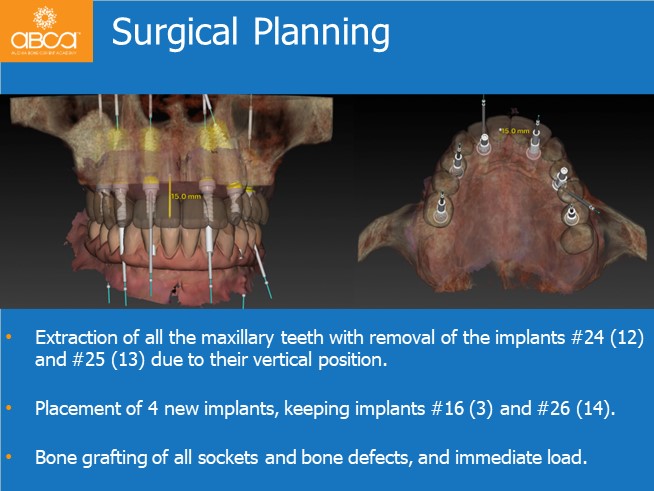 Clinical Case