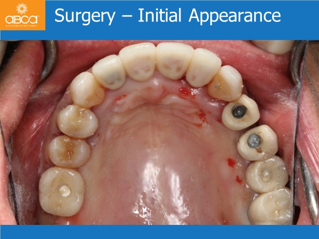 Clinical Case