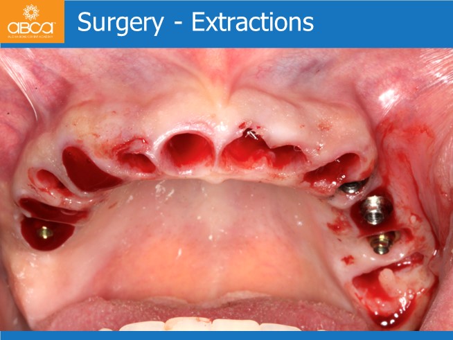 Clinical Case