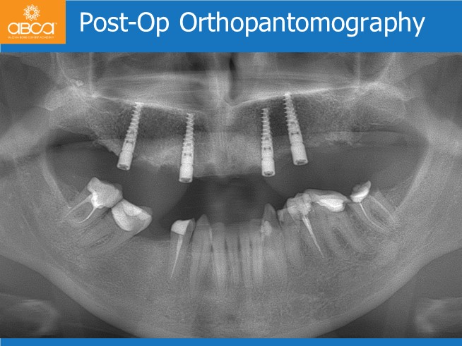 Clinical Case