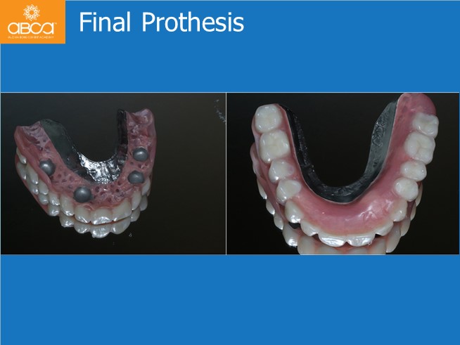 Clinical Case