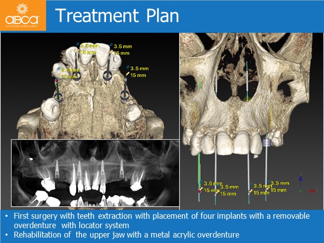 Clinical Case