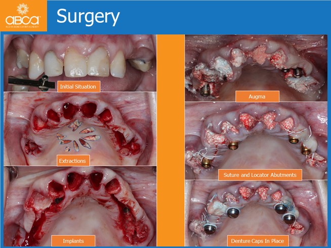 Clinical Case