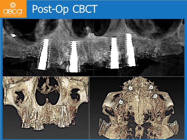 Clinical Case