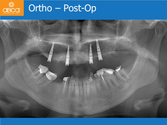 Clinical Case