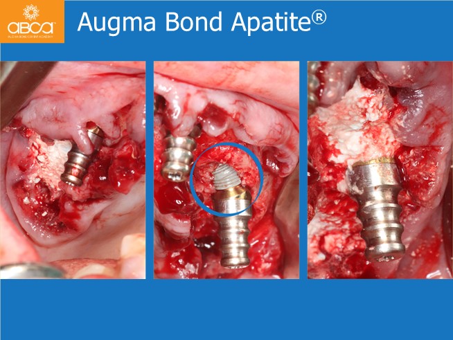 Clinical Case