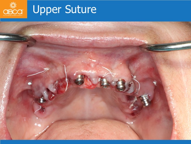 Clinical Case