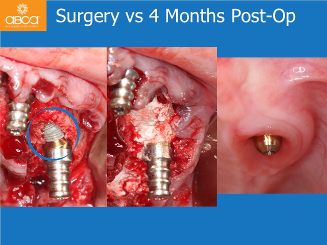 Clinical Case