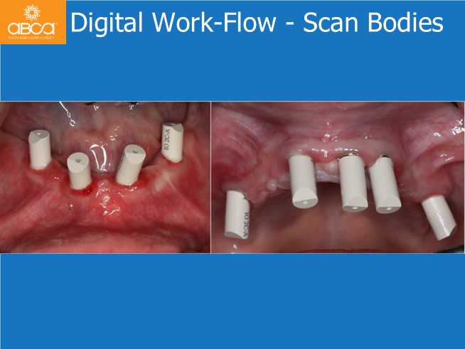 Clinical Case