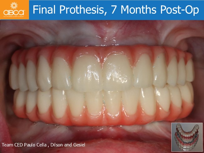 Clinical Case