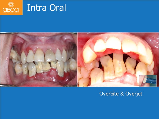 Clinical Case