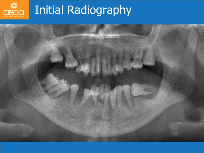 Clinical Case