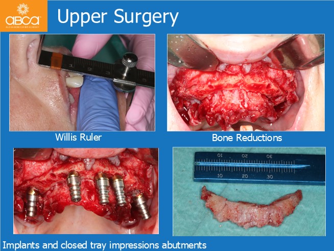 Clinical Case