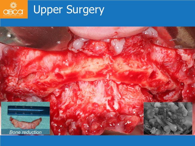 Clinical Case