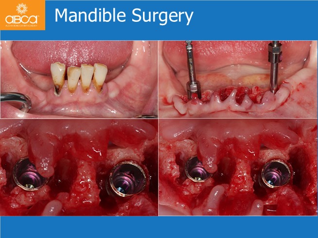 Clinical Case