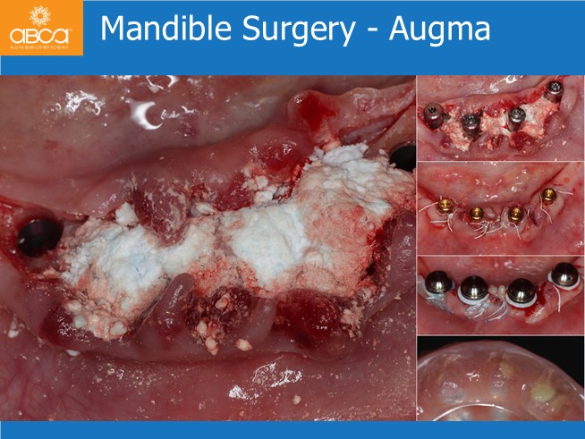 Clinical Case