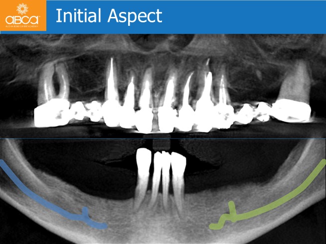 Clinical Case