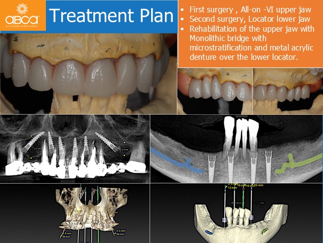 Clinical Case