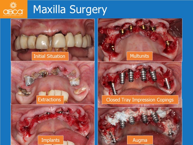 Clinical Case