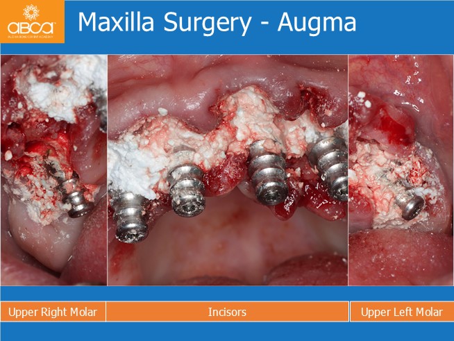 Clinical Case