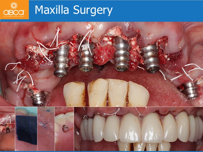 Clinical Case