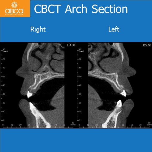 Clinical Case